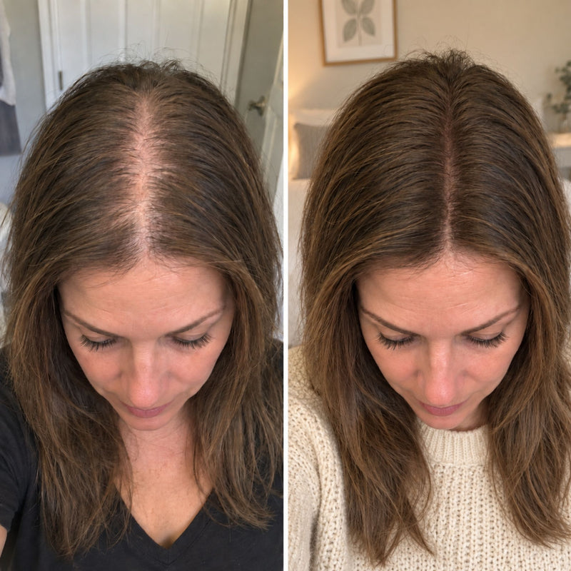 Before and after result